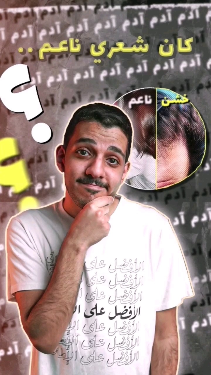 ليش الناس شعرهم ناعم وهم صغار؟